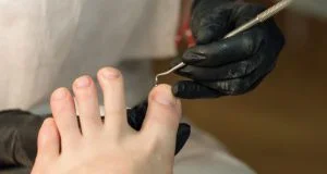 Diplomado en Técnicas quirúrgicas de patología del pie