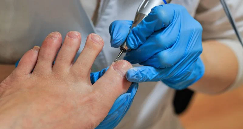 Diplomado en Técnicas quirúrgicas de patología del pie