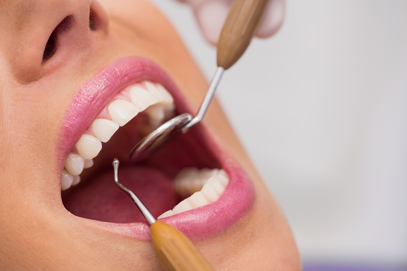 Curso en Estética Dental