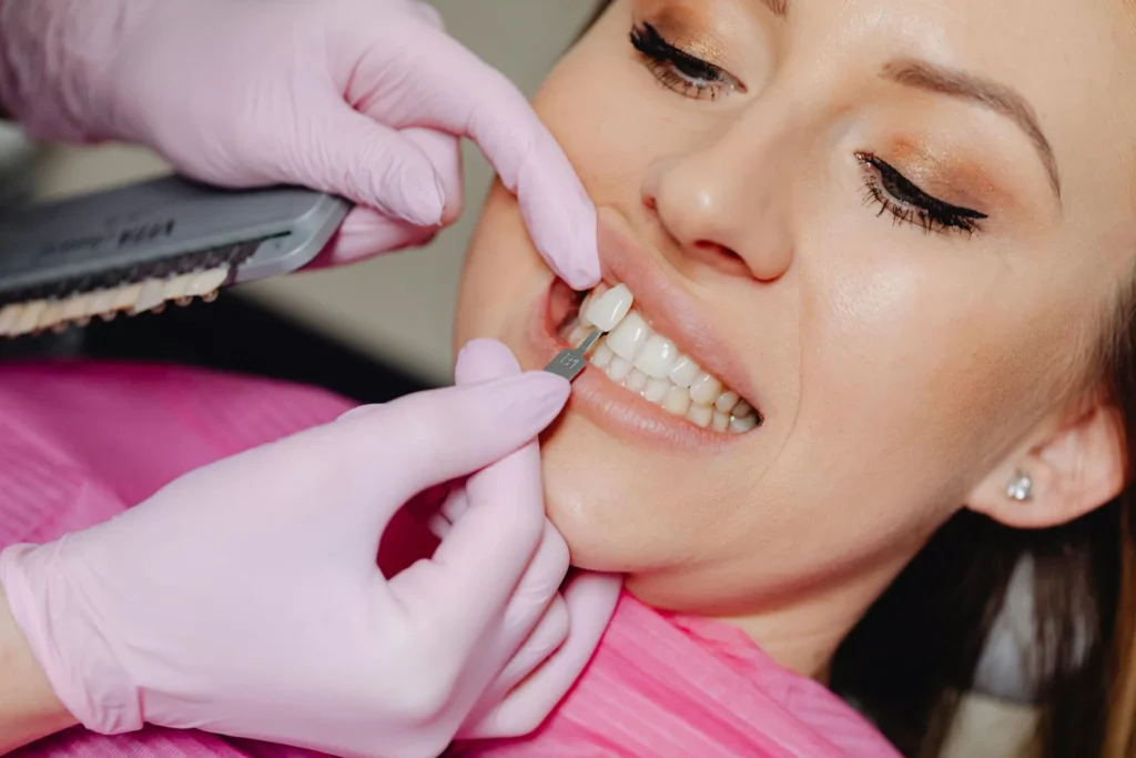 Curso de Estética 3