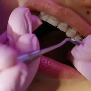 Diplomado en Odontología Digital 1