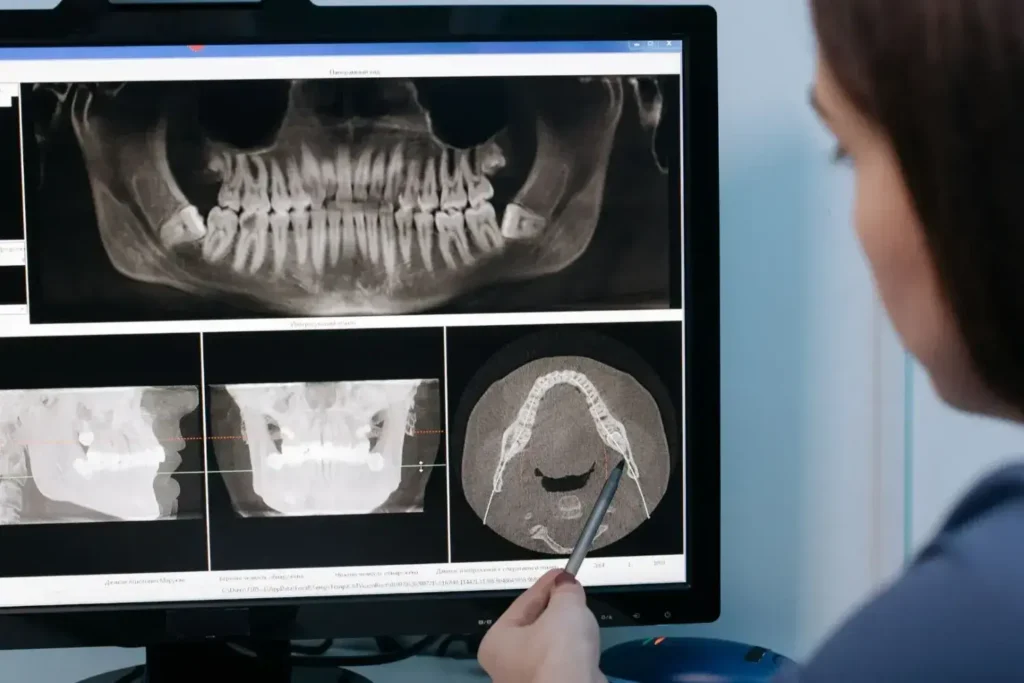 Diplomado en Odontología Digital 2