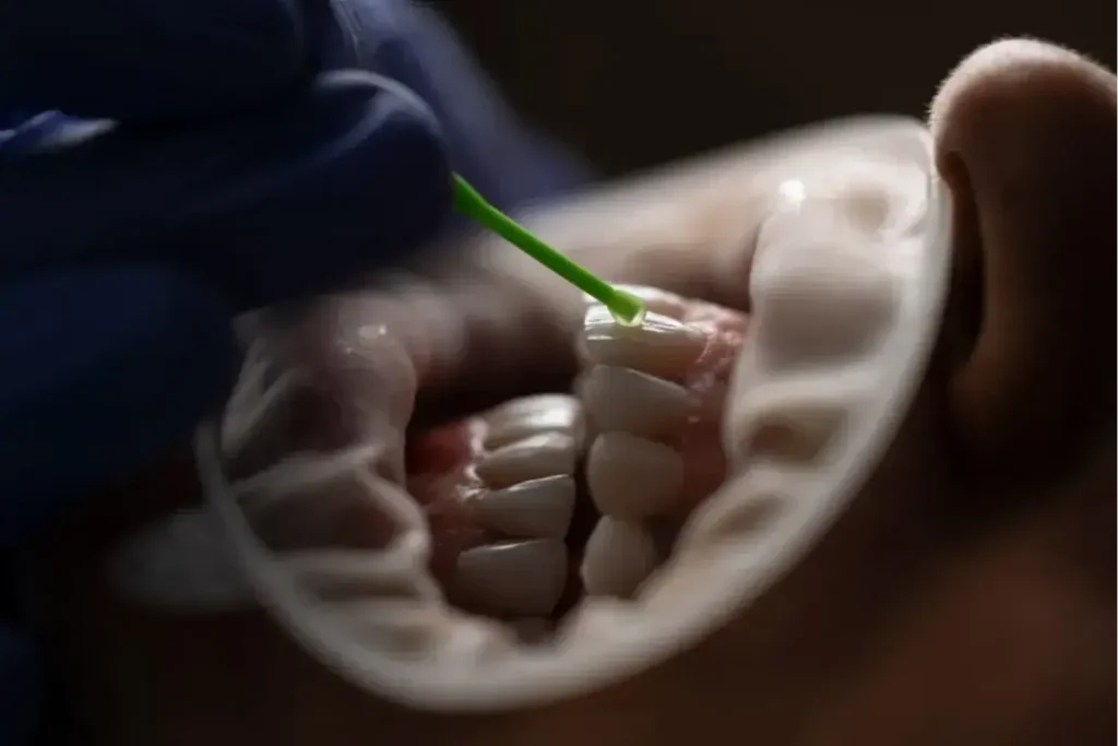 Maestría en Odontología Restauradora 3
