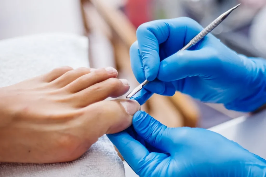 Diplomado en Podología Estética 2