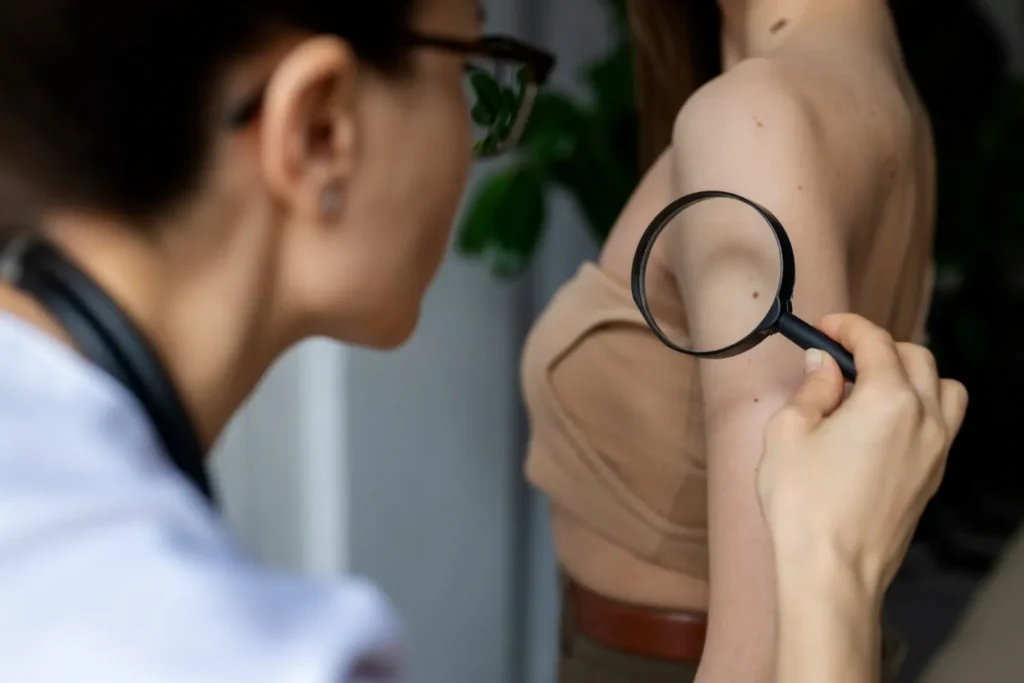 Maestría en Diagnóstico Dermatológico y Triaje de Lesiones Cutáneas 3