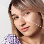 Maestría en Hiperpigmentaciones Melasma PIH y Tratamientos Combinados 2